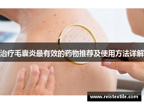 治疗毛囊炎最有效的药物推荐及使用方法详解