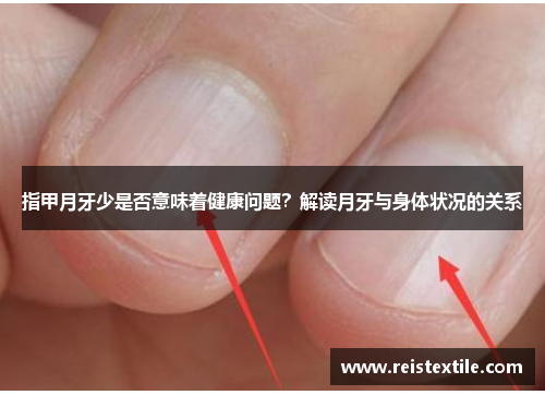 指甲月牙少是否意味着健康问题？解读月牙与身体状况的关系